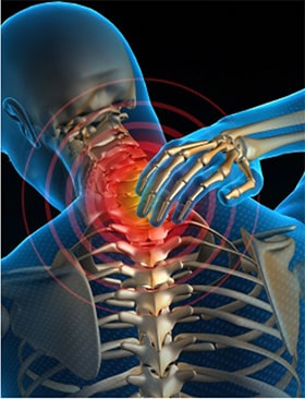 Neck Pain treatment without surgery Ahmedabad