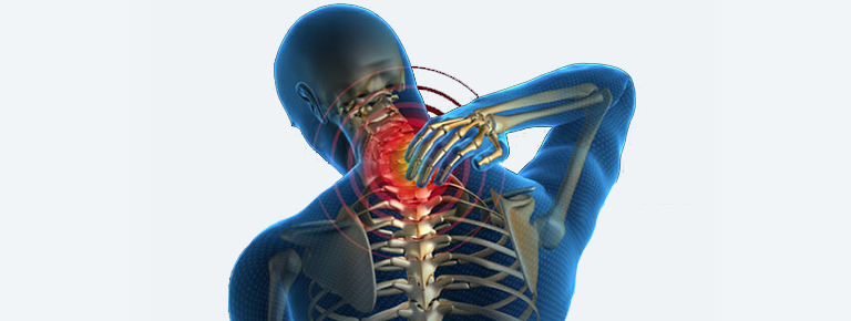 Neck Pain